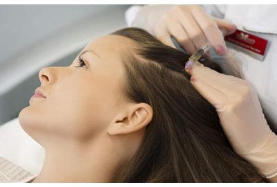Treating Hair Loss: How Mesotherapy can Help