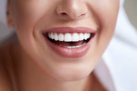 Common Misconceptions About Veneers