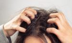 Unlocking Confidence: Effective Female Hair Loss...